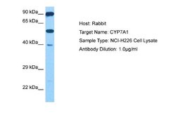 CYP7A1 Rabbit anti-Human, Polyclonal, Novus Biologicals 0.1ml; Unconjugated:Antibodies,